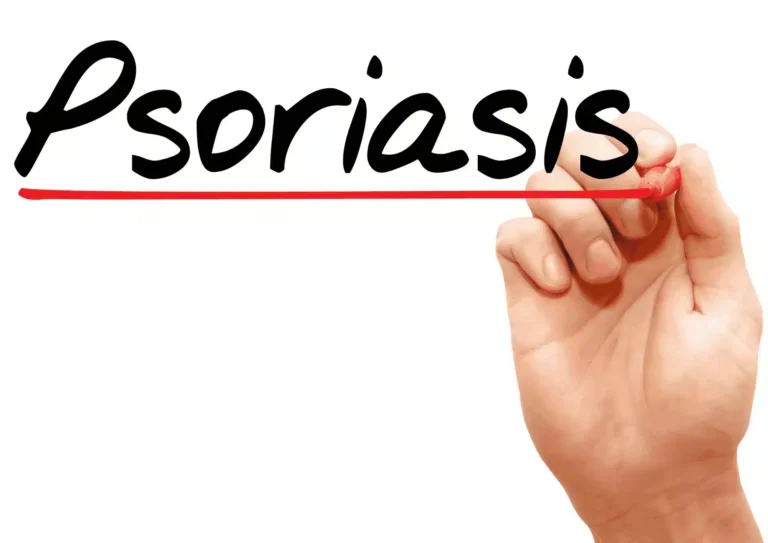 Injectable aesthetics reviews. Scientists Discover Psoriasis Mutations, a Door to New Treatments