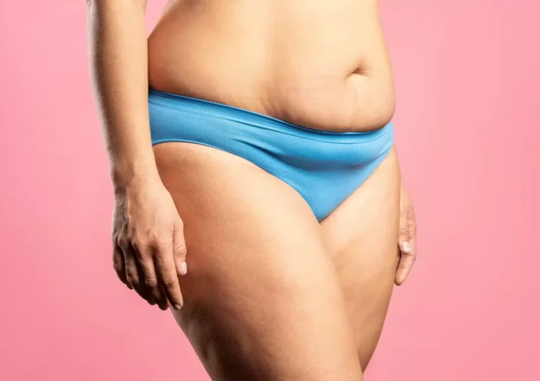 Injectable aesthetics reviews. Tummy Tuck Improves Back Pain, Bladder Symptoms After Childbirth